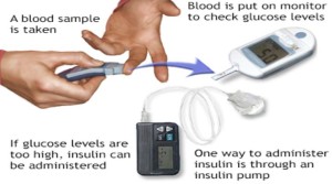 Best Practices for Managing Blood Sugar Level Naturally